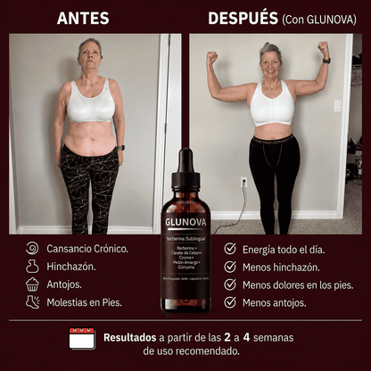 Glunova
